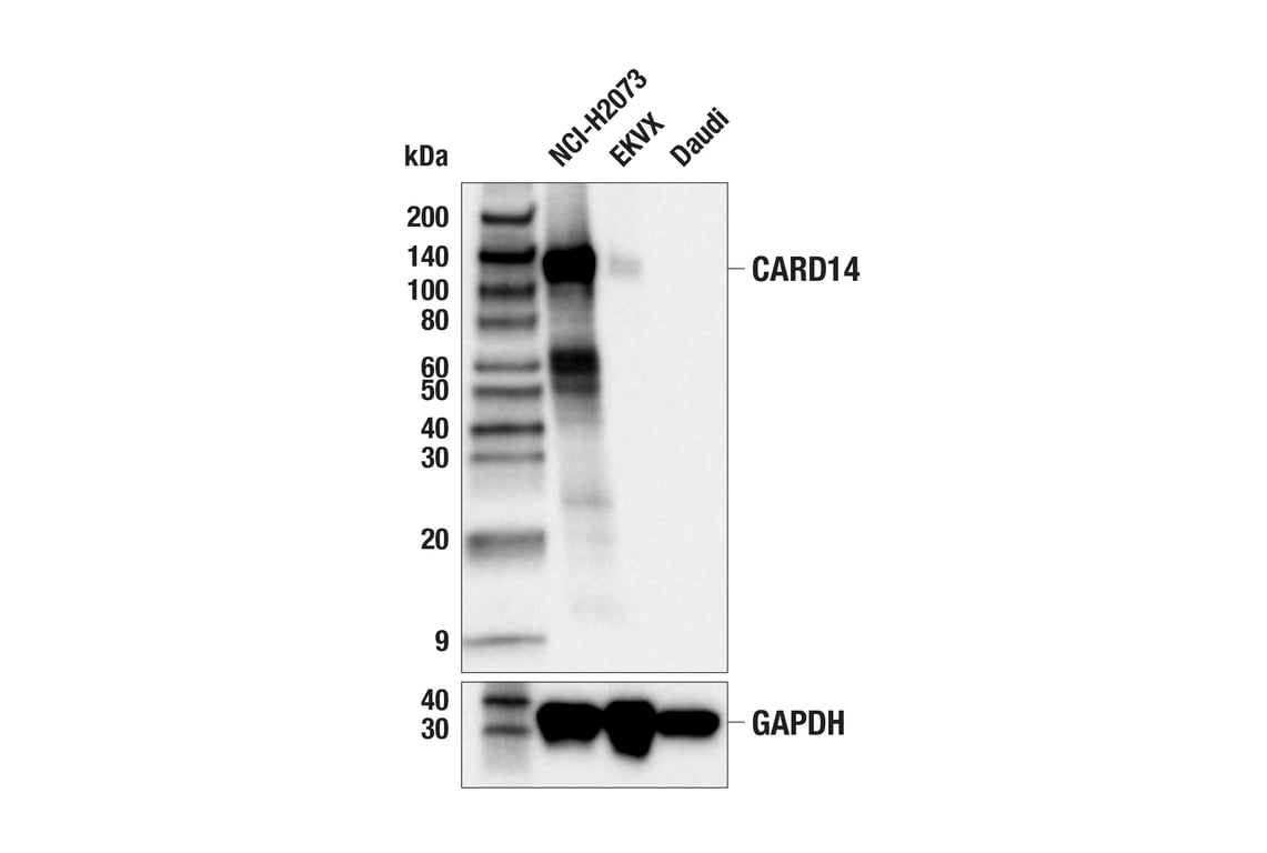 Western Blotting Image 1: CARD14 (E3F8E) Rabbit mAb