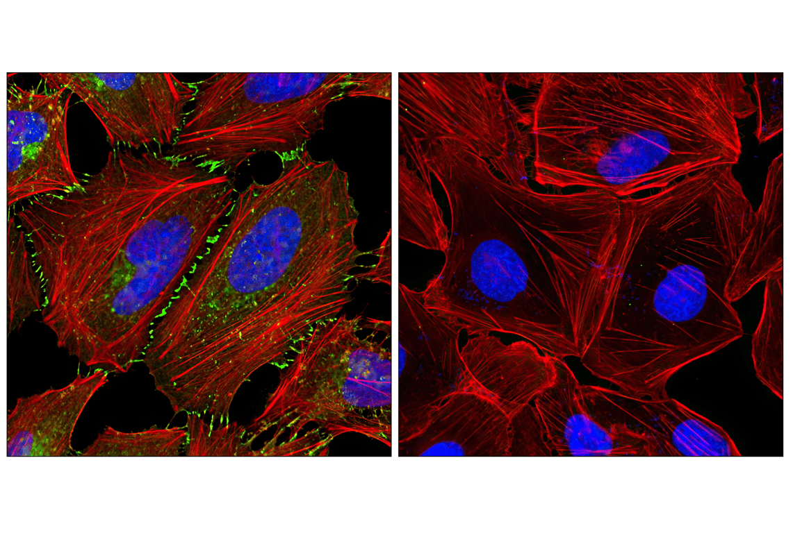 Immunofluorescence Image 1: β-Catenin (L54E2) Mouse mAb