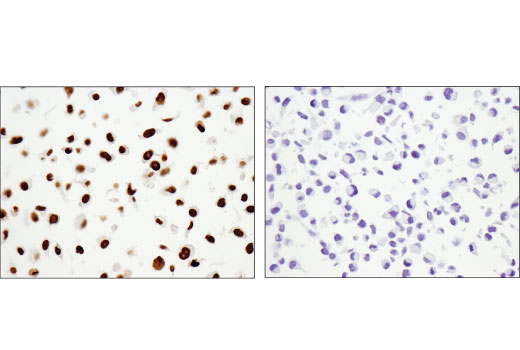 undefined Image 51: BAF Complex IHC Antibody Sampler Kit