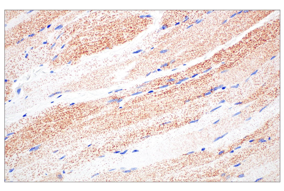 Immunohistochemistry Image 12: Perilipin-2 (E6G6M) Rabbit mAb