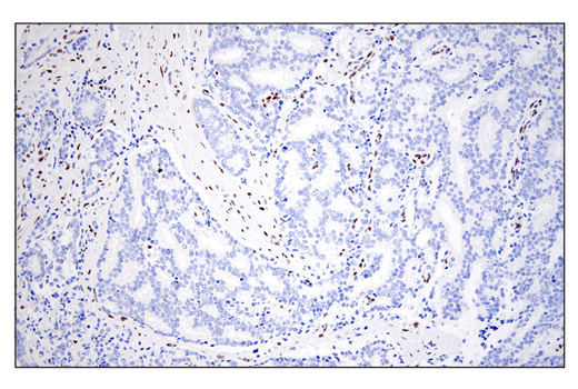 undefined Image 57: Epithelial-Mesenchymal Transition (EMT) IF Antibody Sampler Kit