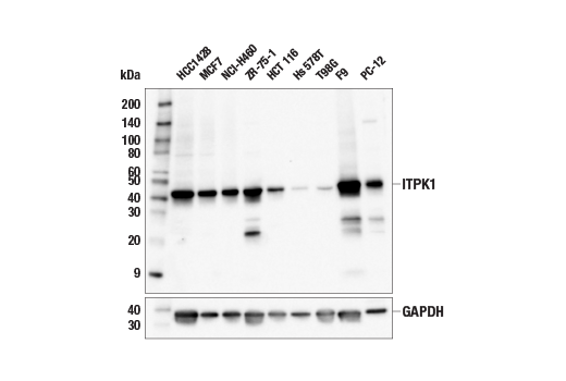 Western Blotting Image 2: ITPK1 (E9H3U) Rabbit mAb