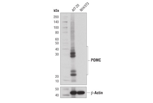 Western Blotting Image 1: POMC (D3R1U) Rabbit mAb