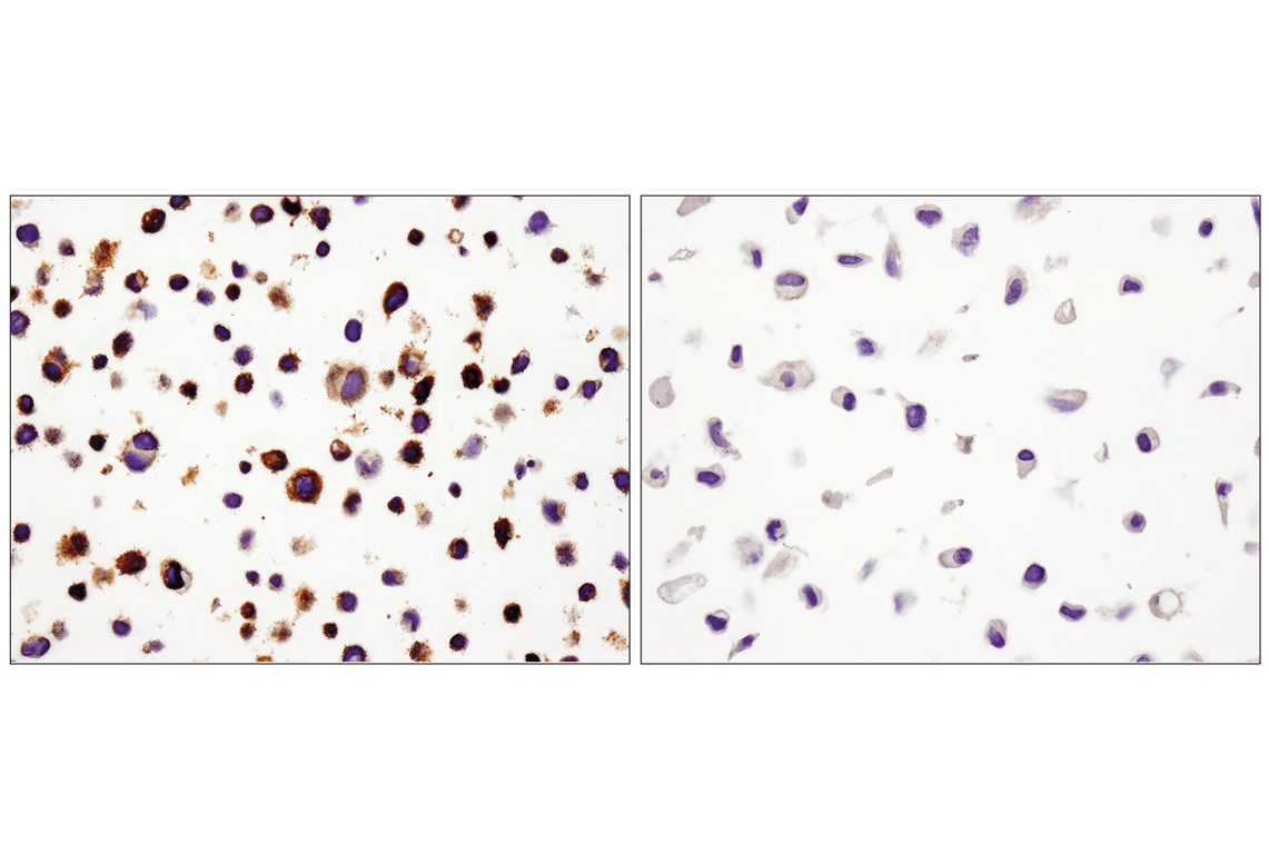 Immunohistochemistry Image 3: PD-L1 (E1L3N<sup>®</sup>) XP<sup>®</sup> Rabbit mAb