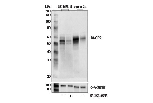 Western Blotting Image 1: BACE2 (E3Y9Q) Rabbit mAb