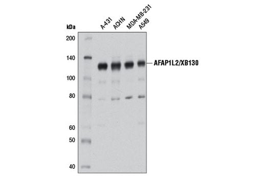 Western Blotting Image 1: AFAP1L2/XB130 (D1B5) Rabbit mAb