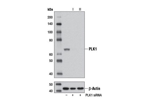 undefined Image 1: SignalSilence<sup>®</sup> PLK1 siRNA I