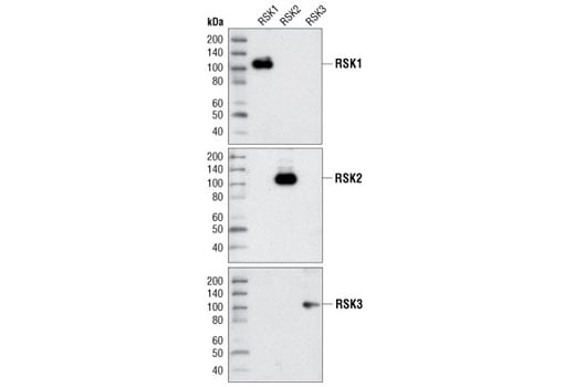 Western Blotting Image 1: RSK1 Antibody