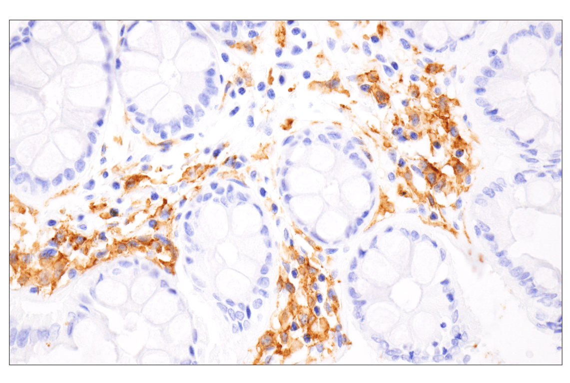 Immunohistochemistry Image 8: HLA-DRA (E9R2Q) XP<sup>®</sup> Rabbit mAb