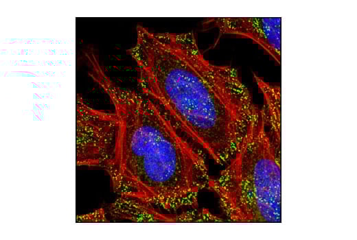 Immunofluorescence Image 1: Numb (C29G11) Rabbit mAb