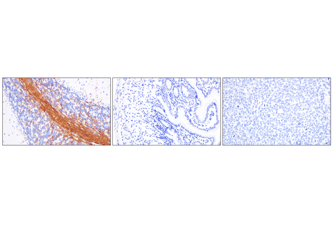 undefined Image 27: Demyelinating Disease Targets Antibody Sampler Kit