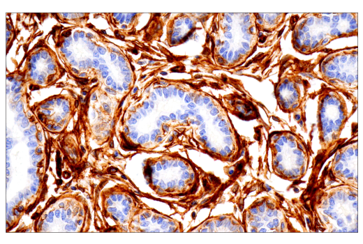 Immunohistochemistry Image 2: Integrin α1/CD49a (E9K2J) XP<sup>®</sup> Rabbit mAb (BSA and Azide Free)