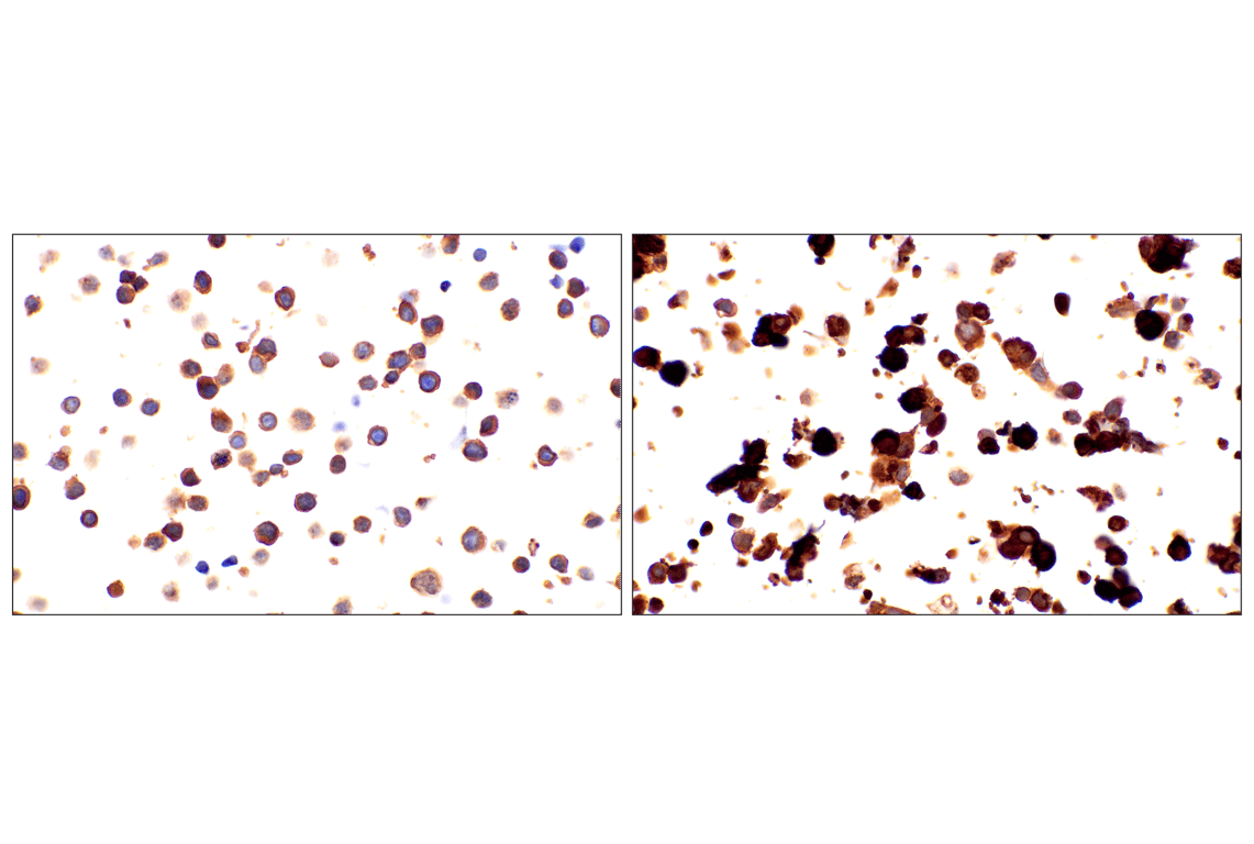 undefined Image 24: Rho-GTPase Antibody Sampler Kit