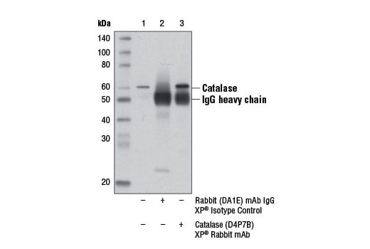 Immunoprecipitation Image 1: Catalase (D4P7B) XP<sup>®</sup> Rabbit mAb