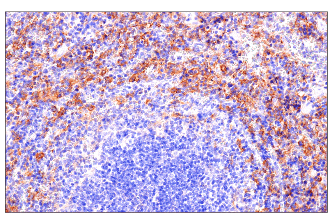 Immunohistochemistry Image 5: Axl (E3Z2H) Rabbit mAb (BSA and Azide Free)