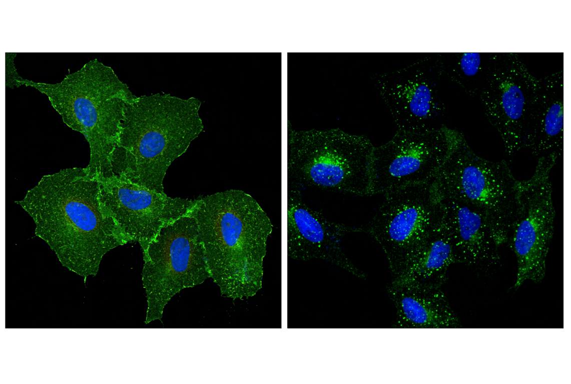 undefined Image 34: Lung Cancer RTK Antibody Sampler Kit