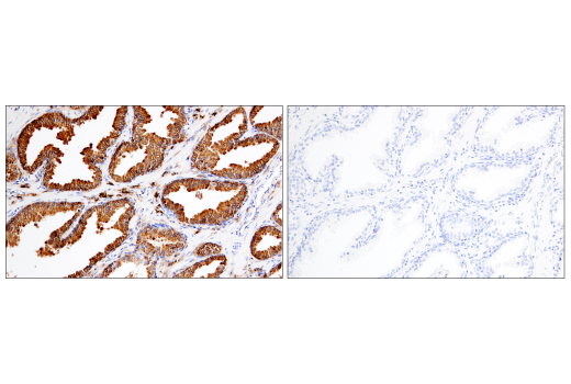 Immunohistochemistry Image 9: CD38 (E7Z8C) XP<sup>®</sup> Rabbit mAb (BSA and Azide Free)