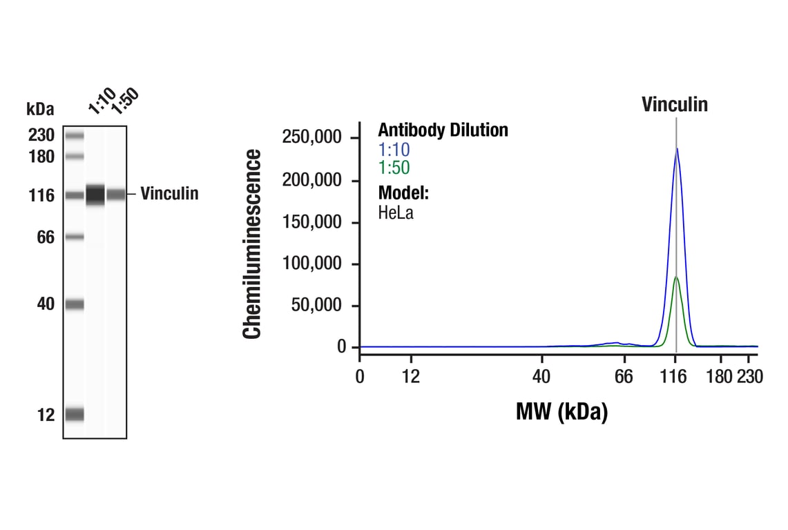 Western Blotting Image 1: Vinculin Antibody