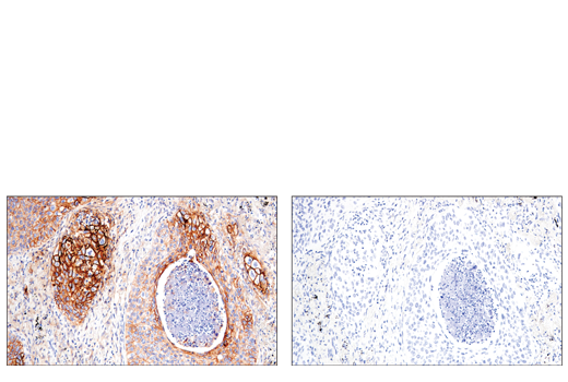 Immunohistochemistry Image 7: CD54/ICAM-1 (E3Q9N) XP<sup>®</sup> Rabbit mAb (BSA and Azide Free)