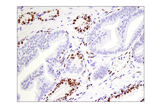 Immunohistochemistry Image 9: Phospho-ATF-2 (Thr71)/ATF-7 (Thr53) (E4A5G) XP<sup>®</sup> Rabbit mAb