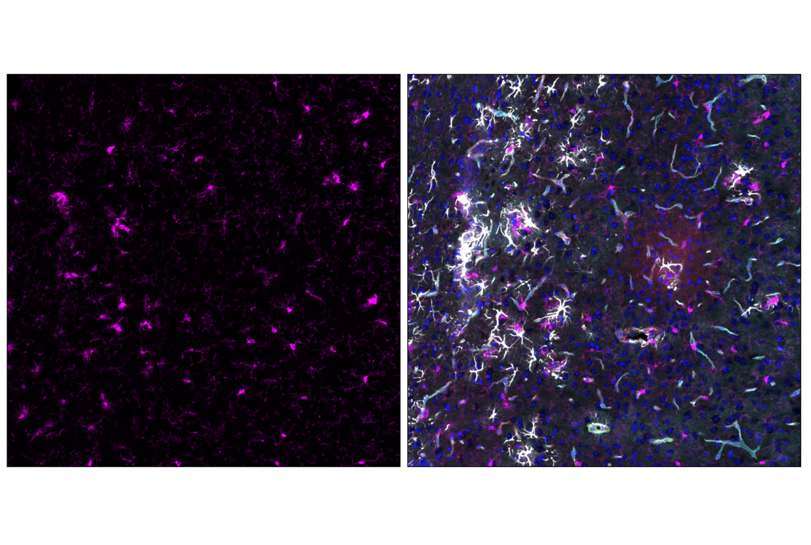 Immunofluorescence Image 4: Iba1/AIF-1 (E4O4W) XP<sup>®</sup>  Rabbit mAb (Alexa Fluor<sup>®</sup> 647 Conjugate)
