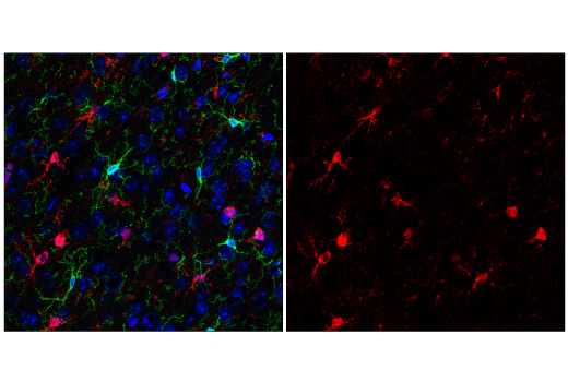 Immunofluorescence Image 2: S100B (E7C3A) Rabbit mAb