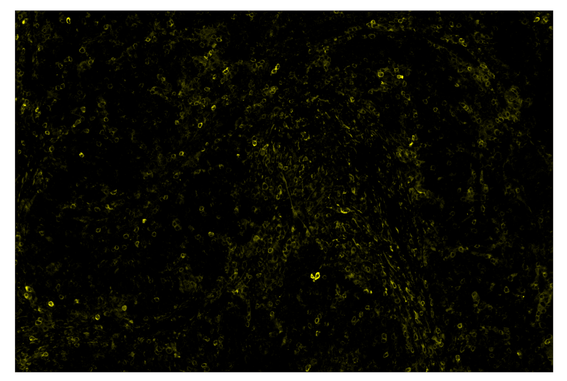 Immunohistochemistry Image 3: Phospho-SLP-76 (Ser376) (E3G9U) & CO-0018-488 SignalStar<sup>™</sup> Oligo-Antibody Pair