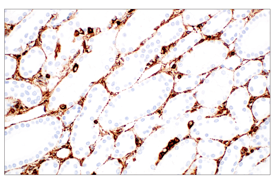 Immunohistochemistry Image 4: Vimentin (D21H3) XP<sup>®</sup> Rabbit mAb (BSA and Azide Free)