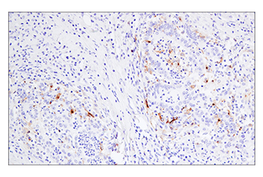 Immunohistochemistry Image 2: 4-1BB/CD137/TNFRSF9 (E6Z7F) XP<sup>®</sup> Rabbit mAb (BSA and Azide Free)