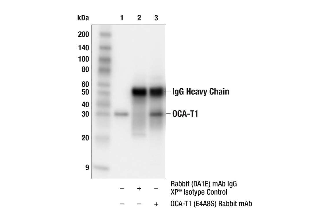 Immunoprecipitation Image 1: OCA-T1 (E4A8S) Rabbit mAb