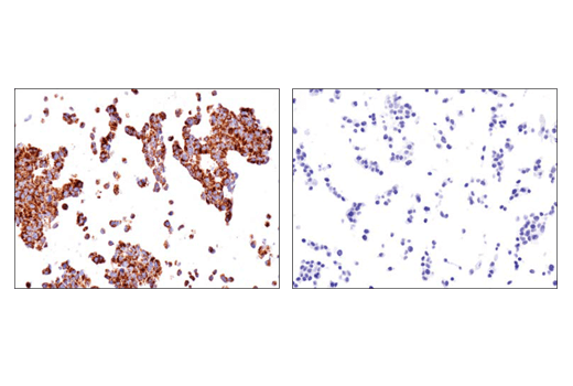 undefined Image 13: Branched-Chain Amino Acid Metabolism Antibody Sampler Kit
