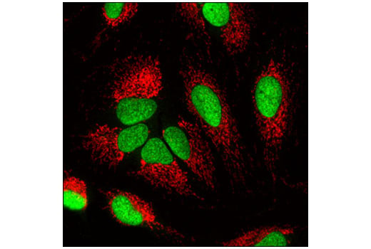 Immunofluorescence Image 1: Ubiquityl-Histone H2B (Lys120) (D11) XP<sup>®</sup> Rabbit mAb (BSA and Azide Free)