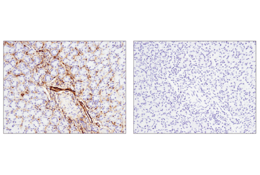 Immunohistochemistry Image 3: CD39/NTPDase 1 (E2X6B) XP<sup>®</sup> Rabbit mAb