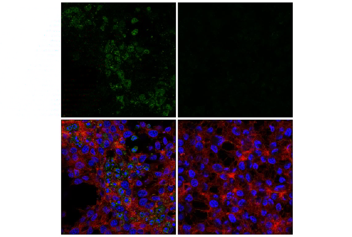 Immunofluorescence Image 1: Cleaved Caspase-8 (Asp374) (E6H8S) Rabbit mAb