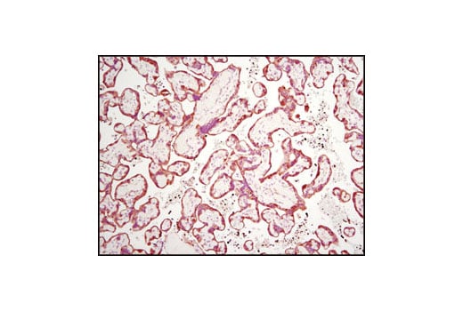 Immunohistochemistry Image 2: TGM2 (D11A6) XP<sup>®</sup> Rabbit mAb
