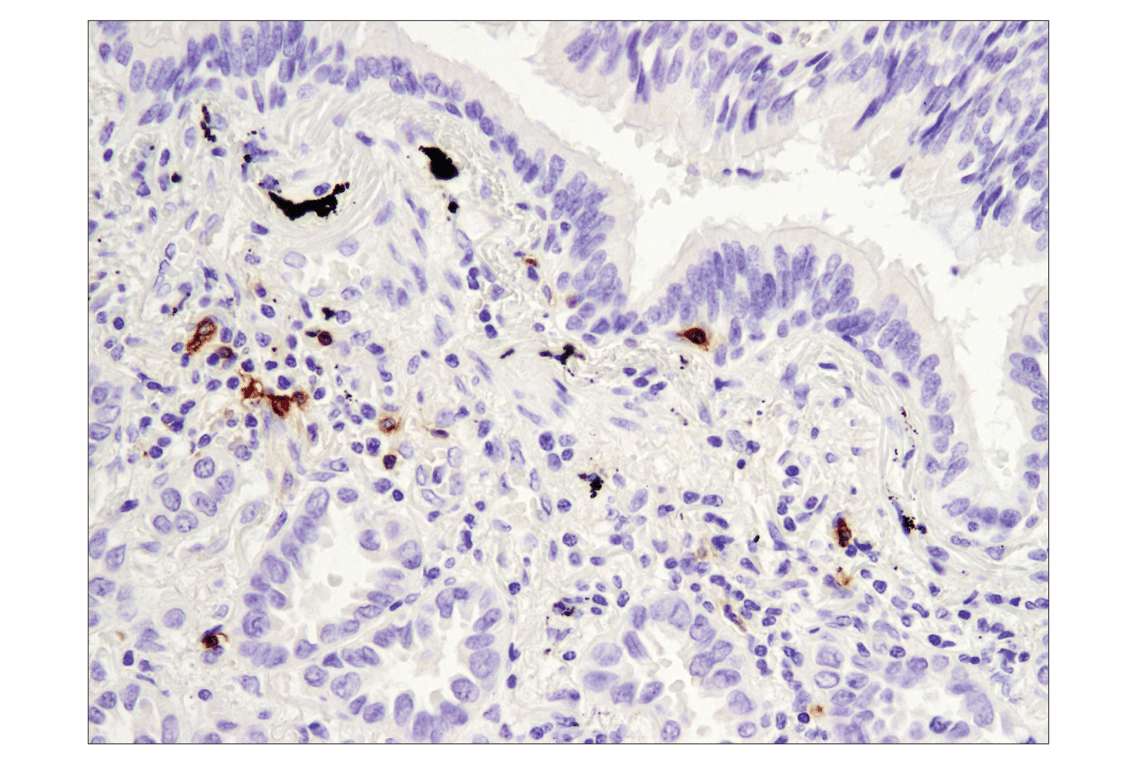 Immunohistochemistry Image 3: OX40 (E9U7O) XP<sup>®</sup> Rabbit mAb (BSA and Azide Free)