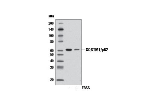 undefined Image 33: Mitophagy Antibody Sampler Kit