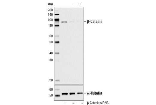 undefined Image 1: SignalSilence<sup>®</sup> β-Catenin siRNA I