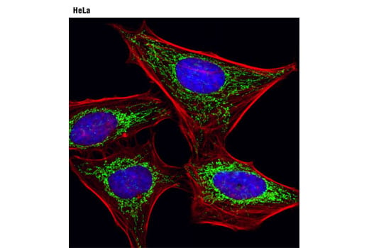 Immunofluorescence Image 1: DLST (D22B1) XP<sup>®</sup> Rabbit mAb