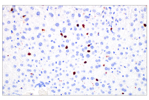 Immunohistochemistry Image 2: CD20 (E3N7O) XP<sup>®</sup> Rabbit mAb (BSA and Azide Free)