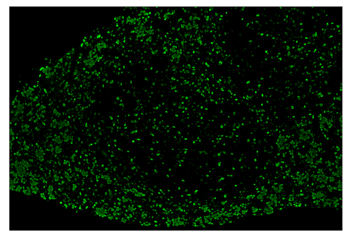 Immunohistochemistry Image 2: Ki-67 (D3B5) & CO-0052-647 SignalStar<sup>™</sup> Oligo-Antibody Pair