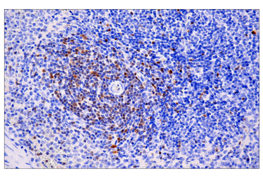 undefined Image 80: Human Exhausted CD8<sup>+</sup> T Cell IHC Antibody Sampler Kit