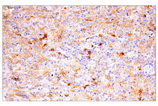 Immunohistochemistry Image 5: LRRK2 (E8Z7T) Mouse mAb