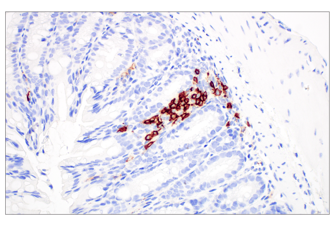 Immunohistochemistry Image 2: CD20 (E3N7O) XP<sup>®</sup> Rabbit mAb