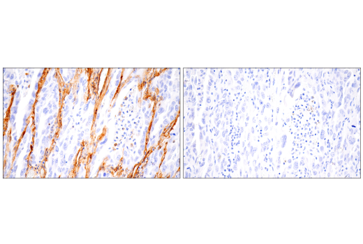 Immunohistochemistry Image 4: Integrin α1/CD49a (E9K2J) XP<sup>®</sup> Rabbit mAb (BSA and Azide Free)