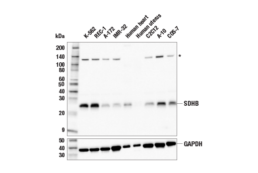 Western Blotting Image 1: SDHB (E3H9Z) XP<sup>®</sup> Rabbit mAb
