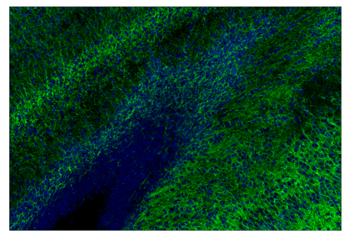 Immunohistochemistry Image 1: Doublecortin (E3S7L) Rabbit mAb (Alexa Fluor® 488 Conjugate)