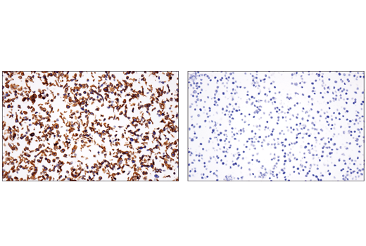 Immunohistochemistry Image 2: CD151 (E4I9J) XP<sup>®</sup> Rabbit mAb