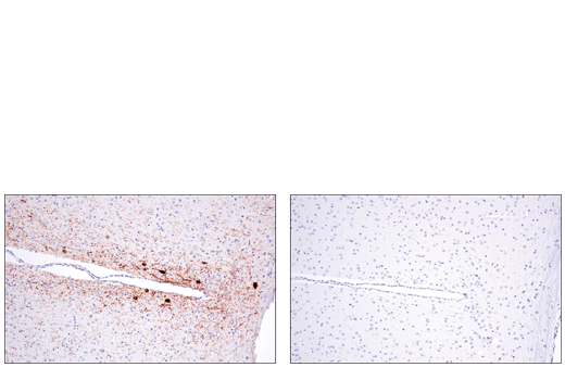 Immunohistochemistry Image 1: Tyrosine Hydroxylase (E2L6M) Rabbit mAb