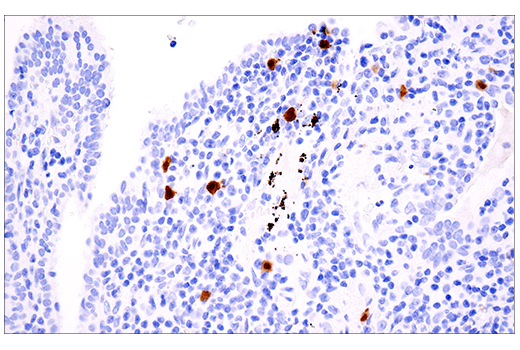 Immunohistochemistry Image 9: Calretinin (E7R6O) XP<sup>®</sup> Rabbit mAb